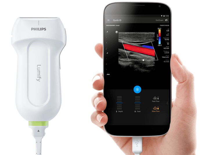 philips lumify ultrasound with phone