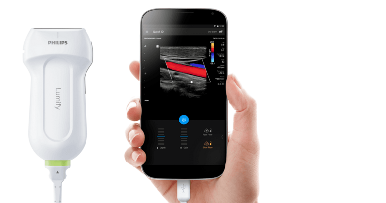 philips lumify ultrasound with phone